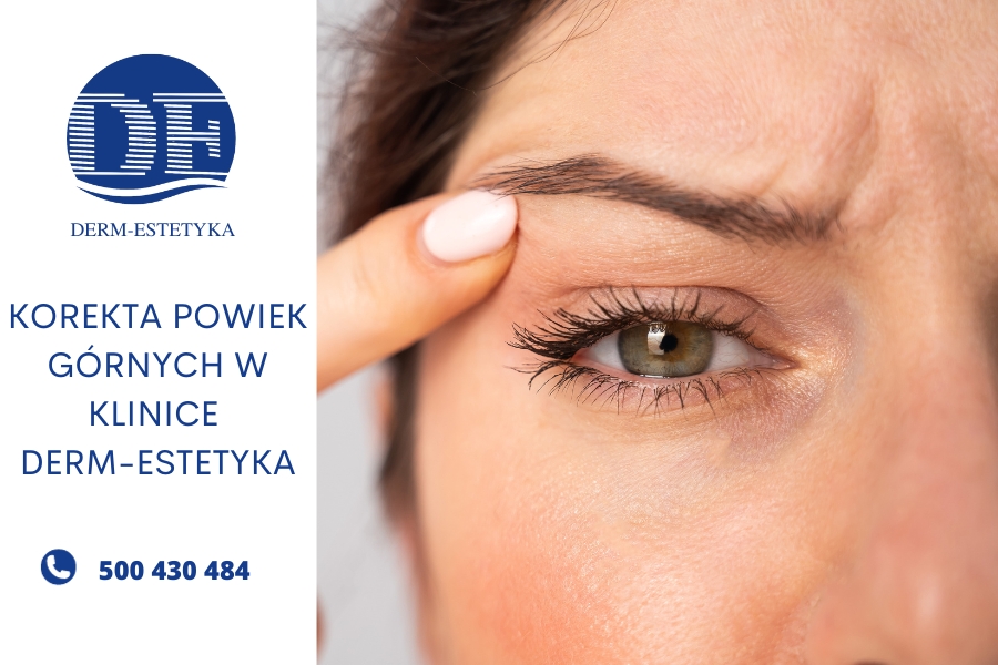 Korekta powiek górnych w klinice Derm-Estetyka